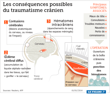 traumatisme_cerebral, F.Duval-Levesque psychopraticien certifie, psychotherapie,  coach, formateur, addiction, dependance, porno-dependance,  phobie, dependance, boulimie, depression, cancer, couple1